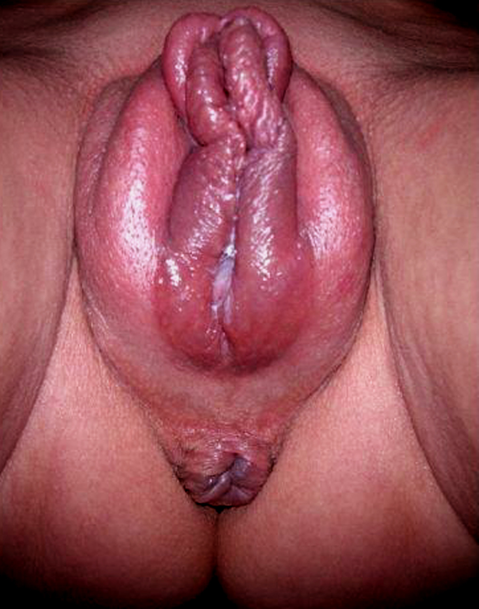 Balloon Knot Ass Big Pussy Lips