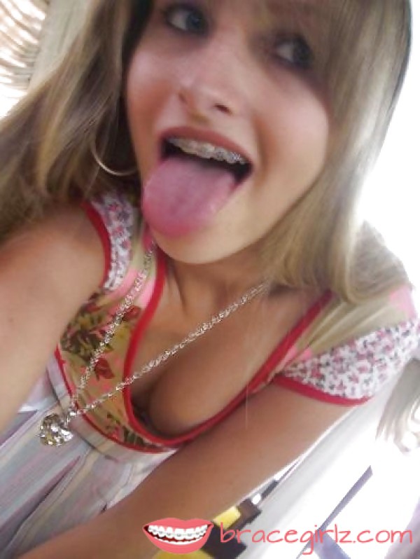 Teen Braces Tits