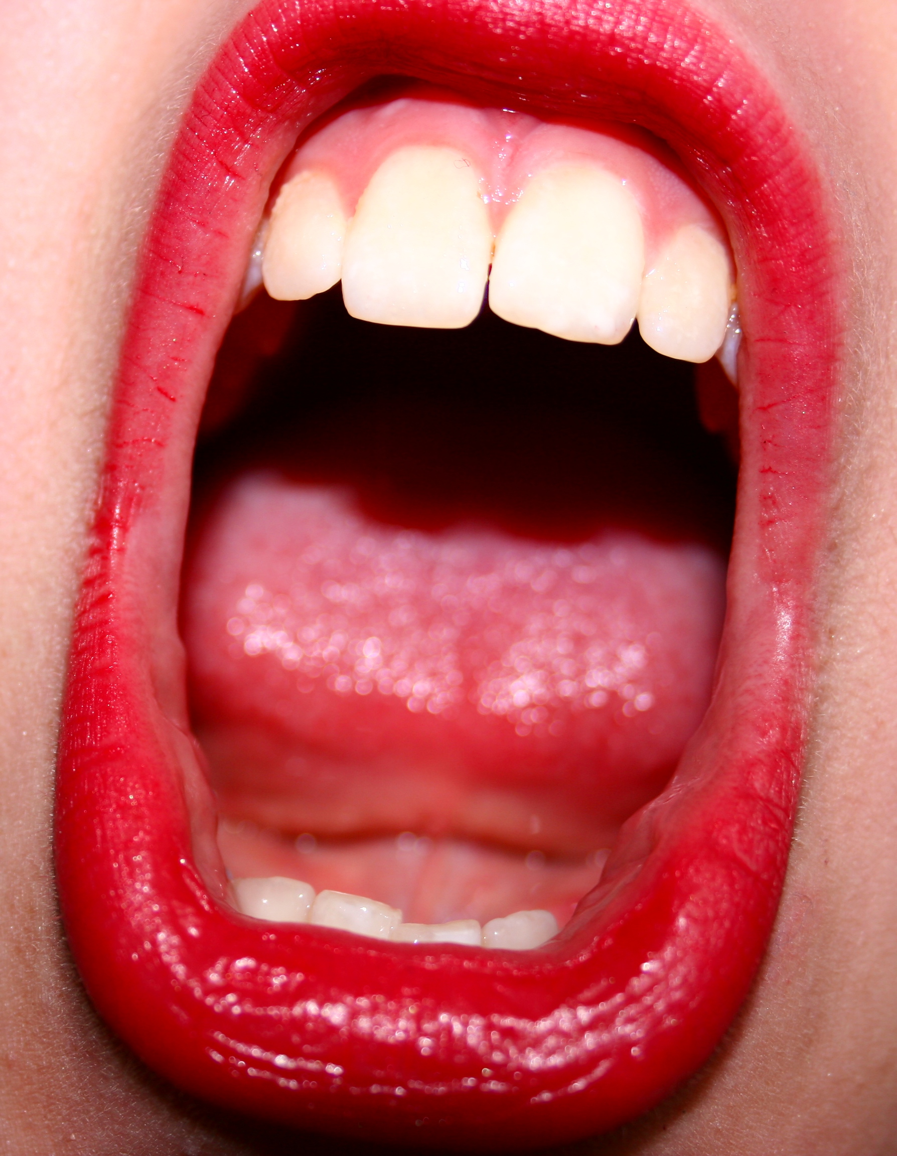 Слизистая оболочка рта