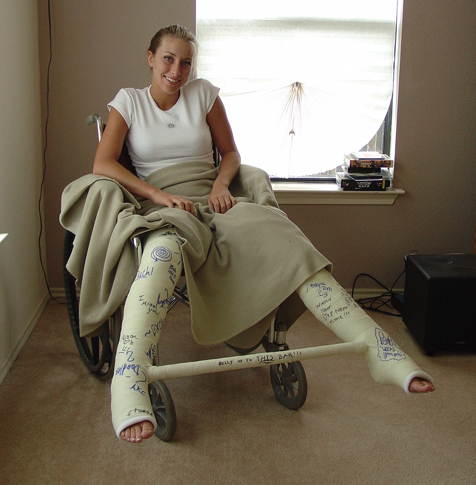 Body cast. Девушка в гипсе в коляске. Гипсовая повязка фетиш.